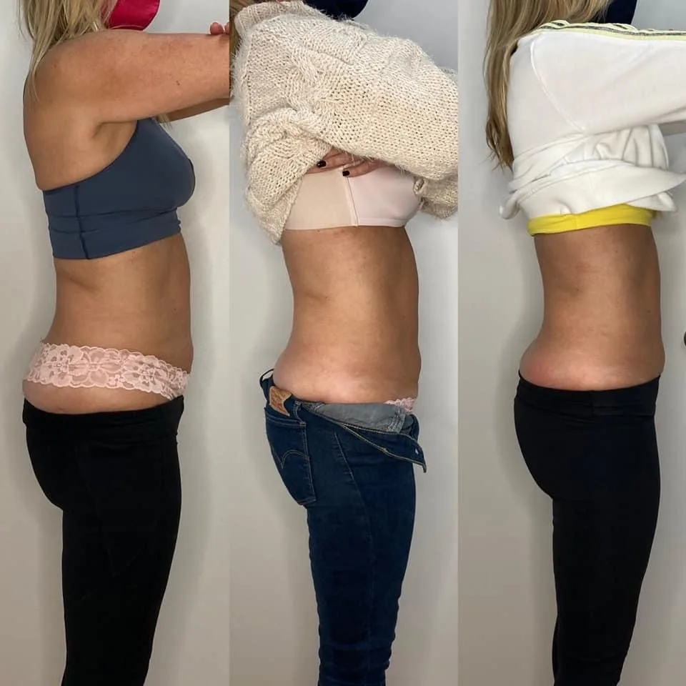 Before and after