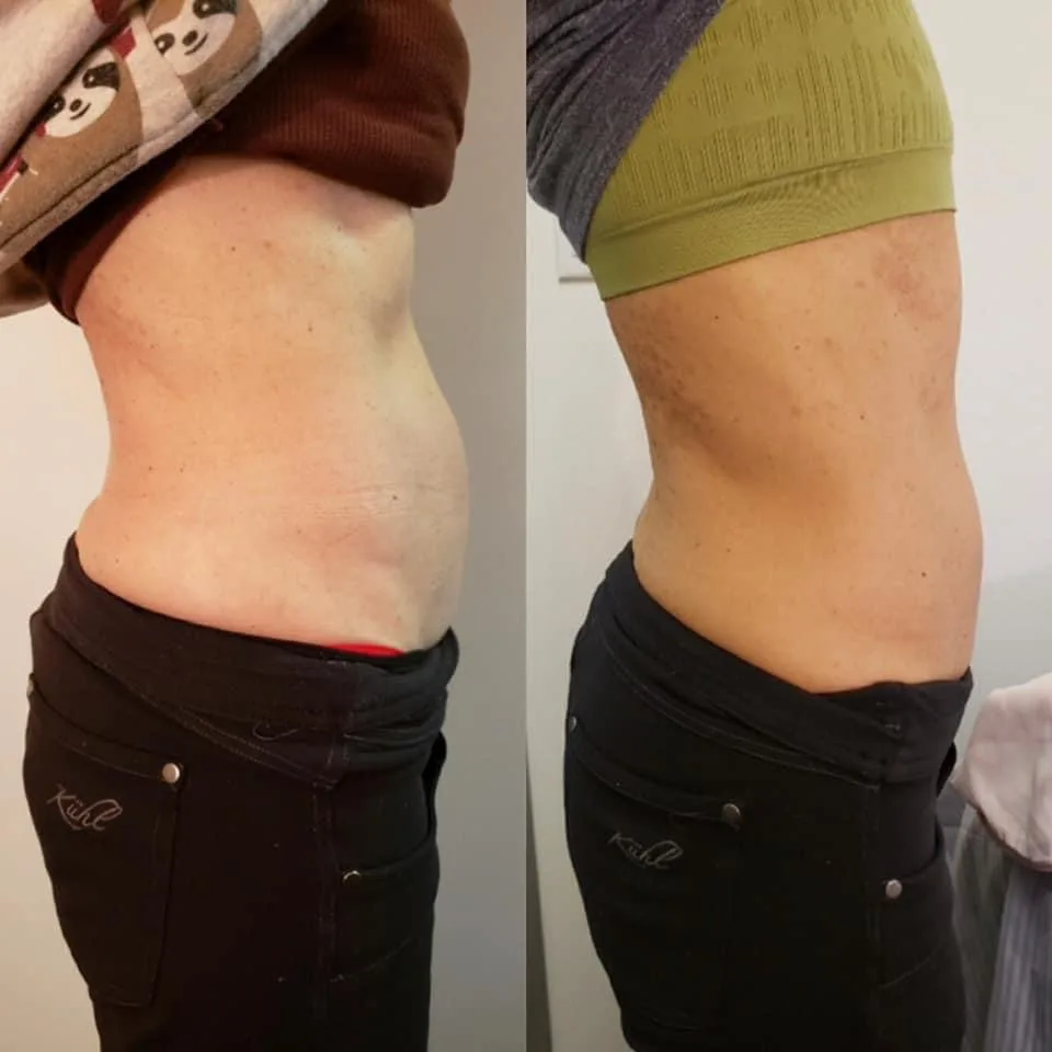 Before and after